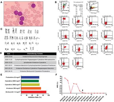 Treatment for a B-cell acute lymphoblastic leukemia patient carrying a rare TP53 c.C275T mutation: A case report